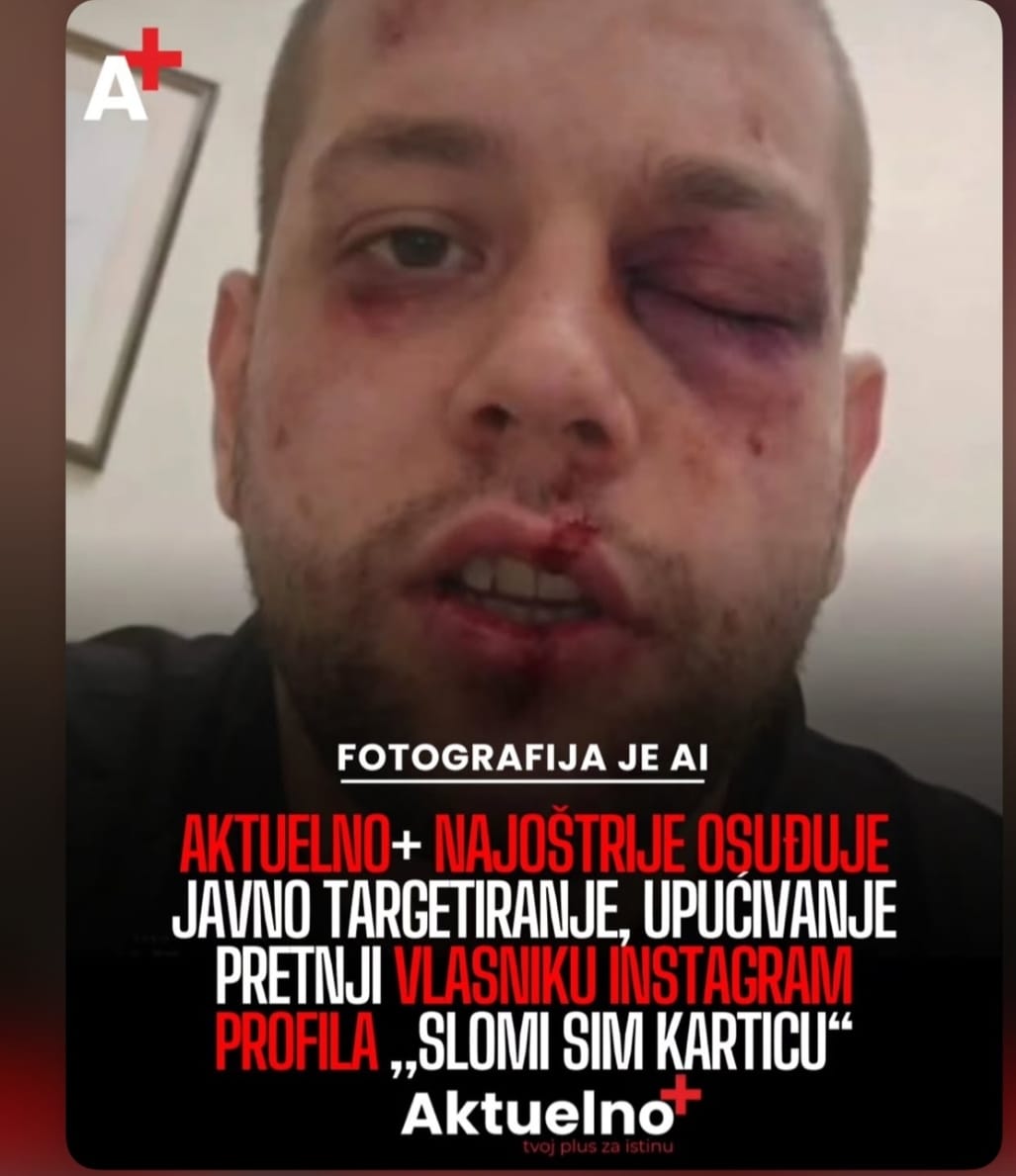 Preuzeto sa Aktuelno+